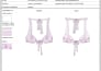 Design Swimwear Resort Bikini Cad Sketches And Fashion Tech Packs By